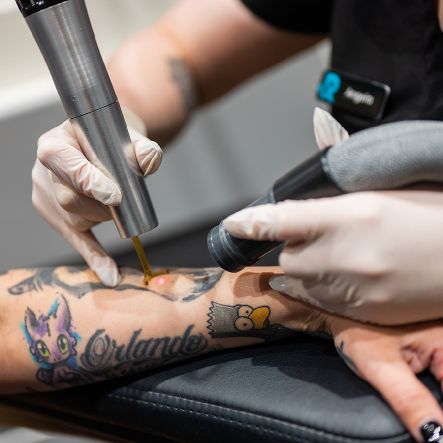 Profile Image of Removery Tattoo Removal & Fading